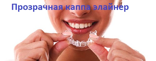 исправление прикуса фото элайнер прозрачная каппа элайнер на зубах пациентка улыбается