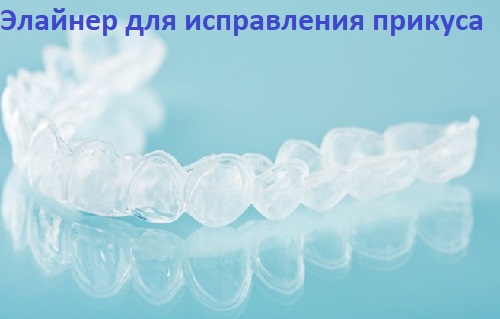 прозрачная каппа фото элайнер Элайнер для исправления прикуса прозрачная каппа на зубы